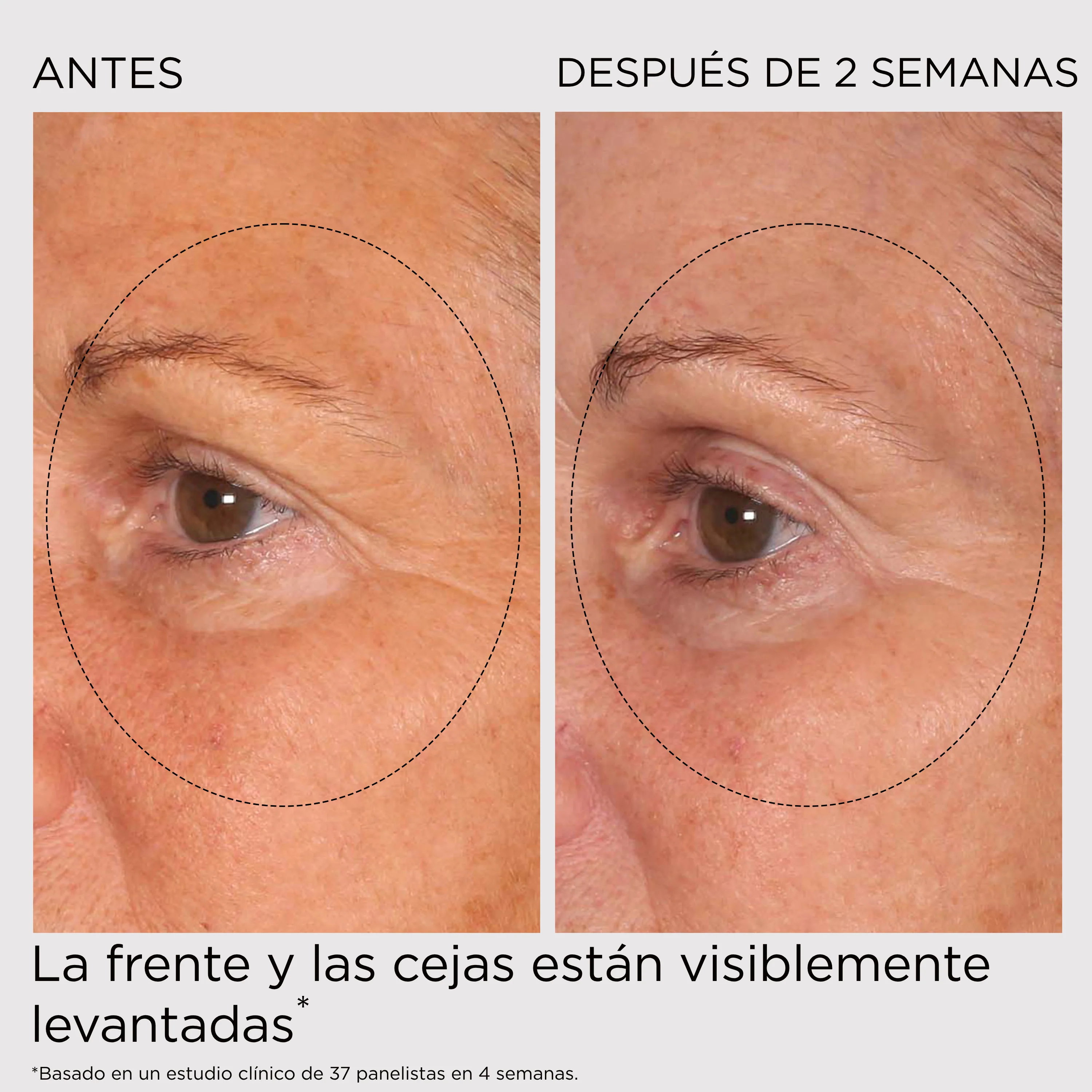PREVAGE® Crema Antiedad Total Textura Ligera - Image 11