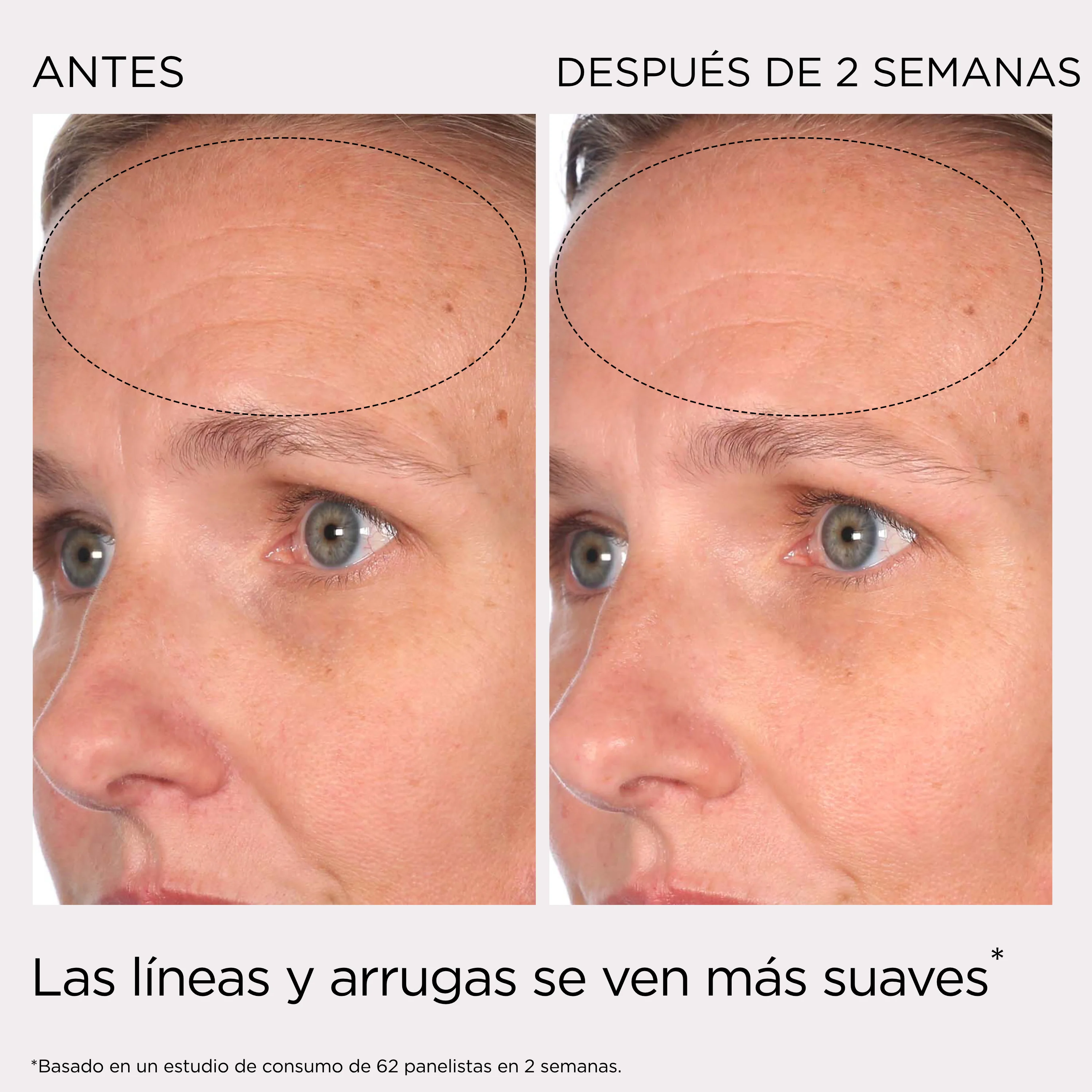 PREVAGE® Crema Antiedad Total Día SPF 30 - Image 13